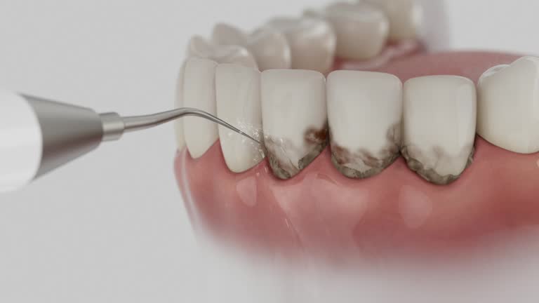 Reliable Dental Implants contractor in Pooler, GA by Smile Center Dentistry